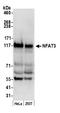 Nuclear factor of activated T-cells, cytoplasmic 4 antibody, A302-770A, Bethyl Labs, Western Blot image 