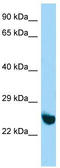 RING finger protein unkempt-like antibody, TA330462, Origene, Western Blot image 