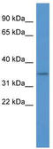 Olfactory Receptor Family 2 Subfamily A Member 5 antibody, TA342704, Origene, Western Blot image 