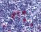 TNF Receptor Superfamily Member 13C antibody, GTX31252, GeneTex, Immunohistochemistry paraffin image 