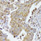 CD52 Molecule antibody, 16-760, ProSci, Immunohistochemistry paraffin image 