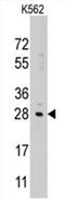 Protein lin-28 homolog B antibody, AP11496PU-N, Origene, Western Blot image 