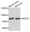 NEDD1 Gamma-Tubulin Ring Complex Targeting Factor antibody, STJ24728, St John