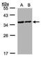 PDZ And LIM Domain 1 antibody, PA5-28701, Invitrogen Antibodies, Western Blot image 