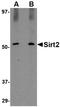 Sirtuin 2 antibody, NBP1-76879, Novus Biologicals, Western Blot image 