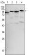 B-Raf Proto-Oncogene, Serine/Threonine Kinase antibody, GTX83134, GeneTex, Western Blot image 