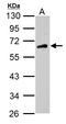 Calcium/Calmodulin Dependent Protein Kinase Kinase 2 antibody, LS-C185972, Lifespan Biosciences, Western Blot image 