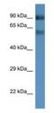 Solute Carrier Family 6 Member 15 antibody, NBP1-74198, Novus Biologicals, Western Blot image 