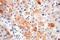 TRNA Methyltransferase 11 Homolog antibody, 17555-1-AP, Proteintech Group, Immunohistochemistry paraffin image 