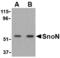 Ski-like protein antibody, A04131-1, Boster Biological Technology, Western Blot image 