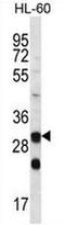 Carbonic Anhydrase 6 antibody, AP50698PU-N, Origene, Western Blot image 