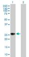 Zinc And Ring Finger 1 antibody, H00084937-B01P, Novus Biologicals, Western Blot image 