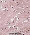 RAR Related Orphan Receptor B antibody, abx027769, Abbexa, Immunohistochemistry paraffin image 