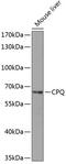 Carboxypeptidase Q antibody, 23-612, ProSci, Western Blot image 