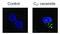 Microtubule Associated Protein 1 Light Chain 3 Beta antibody, PA5-22939, Invitrogen Antibodies, Immunofluorescence image 