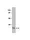 Protein Phosphatase 2 Phosphatase Activator antibody, NBP2-29759, Novus Biologicals, Western Blot image 