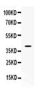 CD48 Molecule antibody, A03281-1, Boster Biological Technology, Western Blot image 