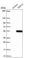 Thyroid Hormone Receptor Interactor 13 antibody, HPA053093, Atlas Antibodies, Western Blot image 