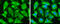 Transgelin antibody, GTX628831, GeneTex, Immunofluorescence image 