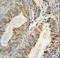 AKT Serine/Threonine Kinase 2 antibody, LS-C156232, Lifespan Biosciences, Immunohistochemistry paraffin image 