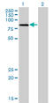 LIM Domain Kinase 2 antibody, LS-C197617, Lifespan Biosciences, Western Blot image 
