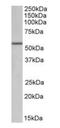 Aldehyde Dehydrogenase 6 Family Member A1 antibody, orb125068, Biorbyt, Western Blot image 