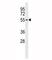 Testis Specific Protein Y-Linked 1 antibody, F40035-0.4ML, NSJ Bioreagents, Western Blot image 