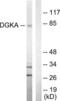 80 kDa diacylglycerol kinase antibody, LS-C118831, Lifespan Biosciences, Western Blot image 