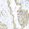 Aspartyl-TRNA Synthetase 2, Mitochondrial antibody, A06034, Boster Biological Technology, Immunohistochemistry frozen image 