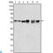 AKT Serine/Threonine Kinase 2 antibody, LS-C812493, Lifespan Biosciences, Immunofluorescence image 