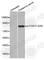 Forkhead Box O1 antibody, AP0172, ABclonal Technology, Western Blot image 