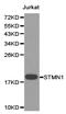 Stathmin 1 antibody, LS-C193092, Lifespan Biosciences, Western Blot image 