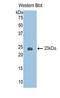Serpin Family A Member 6 antibody, LS-C293534, Lifespan Biosciences, Western Blot image 