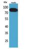 Transferrin Receptor antibody, STJ96739, St John