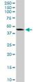 DNA Methyltransferase 3 Like antibody, H00029947-D01P, Novus Biologicals, Western Blot image 