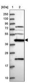 Creatine Kinase, Mitochondrial 1B antibody, PA5-60387, Invitrogen Antibodies, Western Blot image 