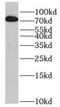 Pre-MRNA Processing Factor 39 antibody, FNab06816, FineTest, Western Blot image 