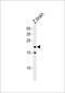 Transcription factor 21 antibody, PA5-72640, Invitrogen Antibodies, Western Blot image 