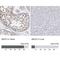 ATP Binding Cassette Subfamily F Member 2 antibody, NBP1-89316, Novus Biologicals, Immunohistochemistry paraffin image 