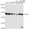 Eukaryotic Translation Initiation Factor 2 Subunit Beta antibody, LS-C749499, Lifespan Biosciences, Western Blot image 