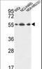 ATP Synthase F1 Subunit Alpha antibody, LS-C156652, Lifespan Biosciences, Western Blot image 