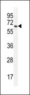 PRAME Family Member 20 antibody, LS-C203697, Lifespan Biosciences, Western Blot image 