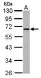 Zinc Finger Protein 215 antibody, NBP2-20977, Novus Biologicals, Western Blot image 