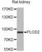 Procollagen-Lysine,2-Oxoglutarate 5-Dioxygenase 2 antibody, A6946, ABclonal Technology, Western Blot image 