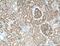 Aquaporin 1 (Colton Blood Group) antibody, 66805-1-Ig, Proteintech Group, Immunohistochemistry paraffin image 