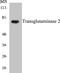 Transglutaminase 2 antibody, EKC1575, Boster Biological Technology, Western Blot image 