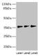 Lipid Droplet Associated Hydrolase antibody, CSB-PA875685LA01HU, Cusabio, Western Blot image 