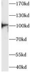 Actinin Alpha 3 (Gene/Pseudogene) antibody, FNab10008, FineTest, Western Blot image 