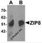 Solute Carrier Family 39 Member 8 antibody, 6095, ProSci, Western Blot image 