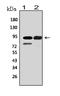 Minichromosome Maintenance Complex Component 6 antibody, LS-C312918, Lifespan Biosciences, Western Blot image 